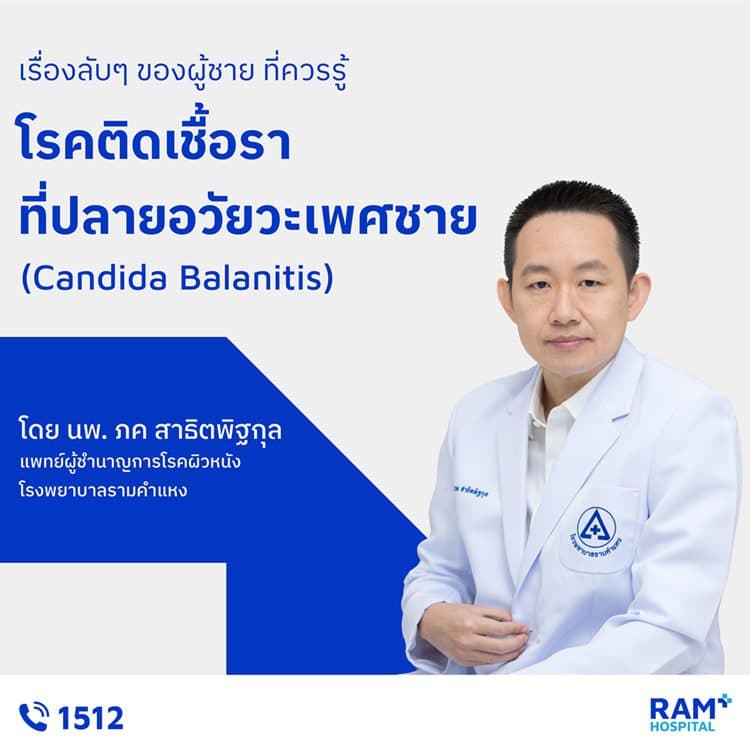 เรื่องลับๆ ของผู้ชาย ที่ควรรู้ : โรคติดเชื้อราที่ปลายอวัยวะเพศชาย